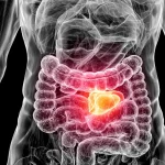 Prostatakrebs Symptome: Medizinische Röntgenvisualisierung des Beckenbereichs mit leuchtend markierter Prostata in Orange, anatomische Darstellung